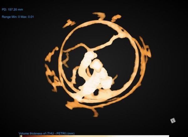 Муравьи меняют структуру гнёзд для предотвращения эпидемий