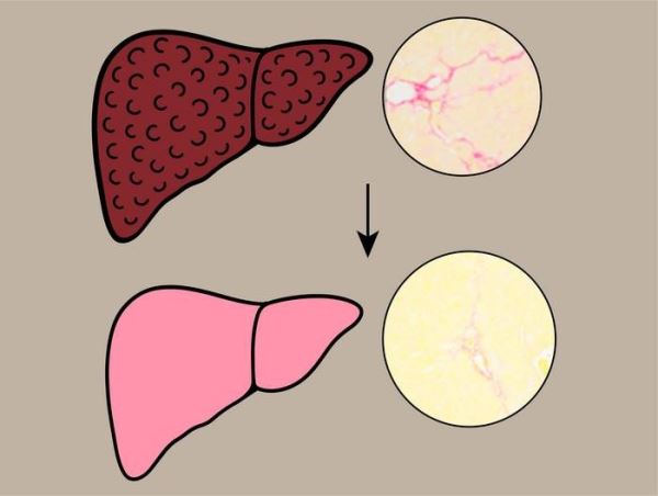 Хна поможет вылечить заболевания печени