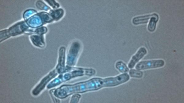 Что общего у людей и дрожжей?