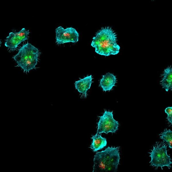 Как иммунные клетки доставляют свой токсичный груз